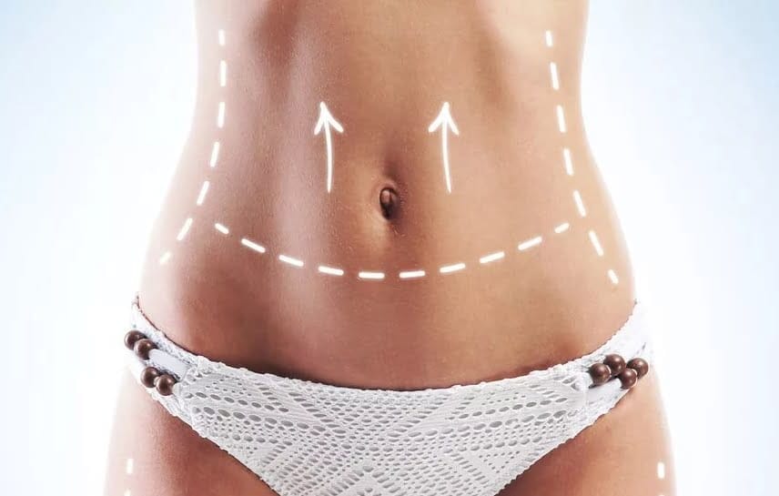 Vibrolipoaspiração uma nova referência em lipoaspiração