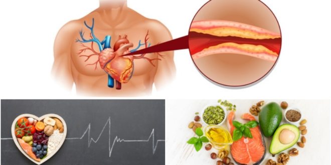 Alimentos indicados para pessoas com colesterol alto